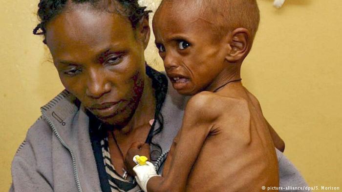 Äthiopien Ein unterernährtes Kind wartet mit seiner Mutter im Krankenhaus (picture-alliance/dpa/S. Morison)