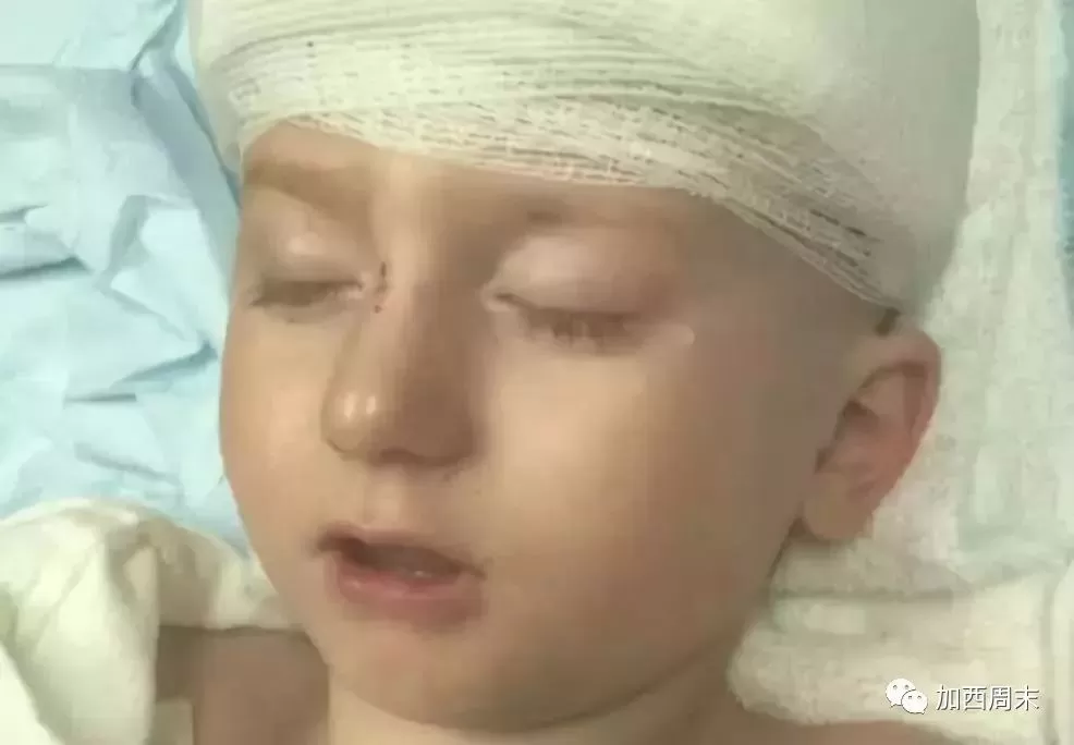 郊狼频现大温！多名华人目击 曾有幼童遭撕咬 它还在游荡…（视频）