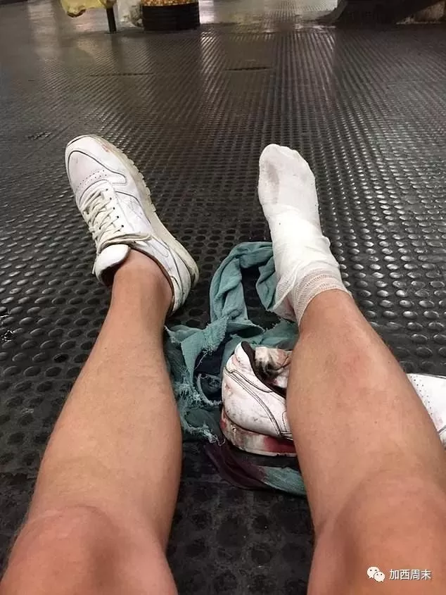 可怕！扶梯突然失控 人群卷入底部！有人惨遭截肢 温哥华男童被绞断腿