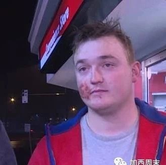 感人！大温男子被5吨卡车撞倒 因为这个死而复生！昨夜一幕温暖世人