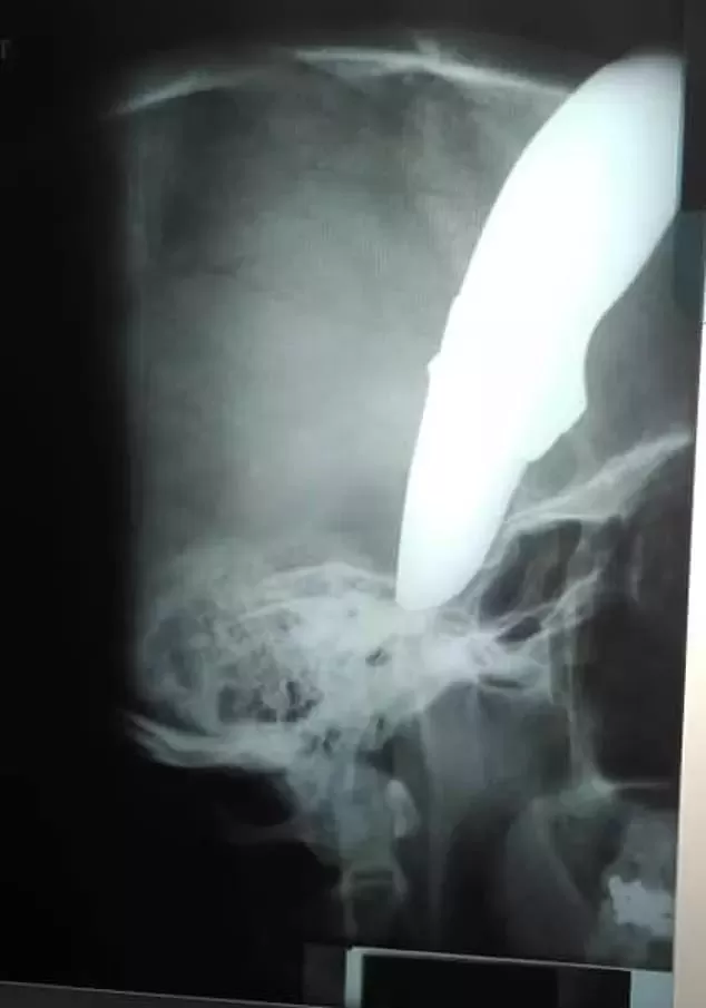 可怕！加拿大小伙上班途中连中15枪 男子头上被插刀！事后竟都选择这样做……