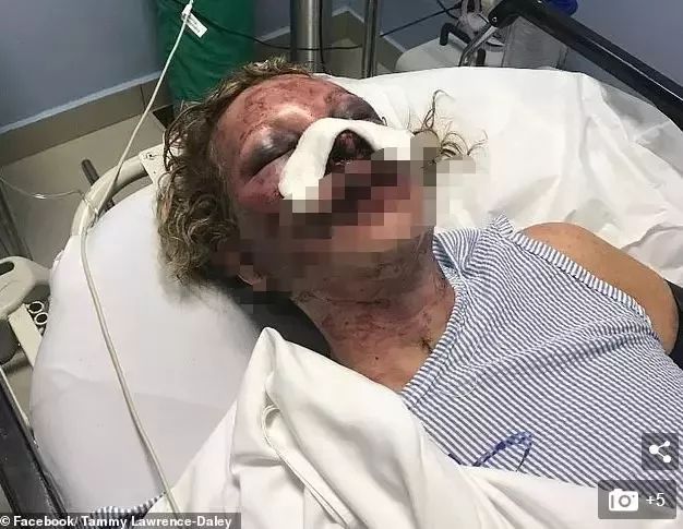 5天3人暴毙! 在旅游胜地喝了一杯酒 美少妇当场惨死 加拿大发旅游警报 这里去不得!