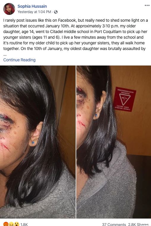 愤怒! 大温14岁亚裔女孩在学校遭男学生围殴 脸被踹到破相! 妈妈崩溃!