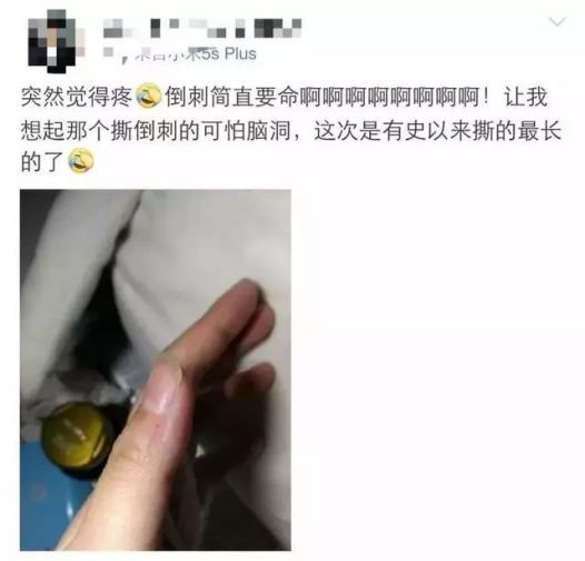 警惕! 男子手指长满癌细胞 竟是因为人人都爱做的小动作!