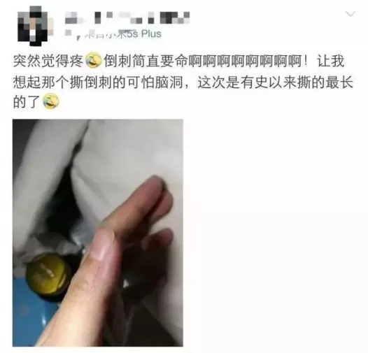 警惕! 男子手指长满癌细胞 竟是因为人人都爱做的小动作!