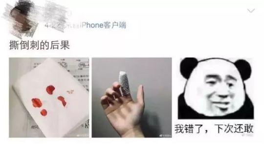 警惕! 男子手指长满癌细胞 竟是因为人人都爱做的小动作!