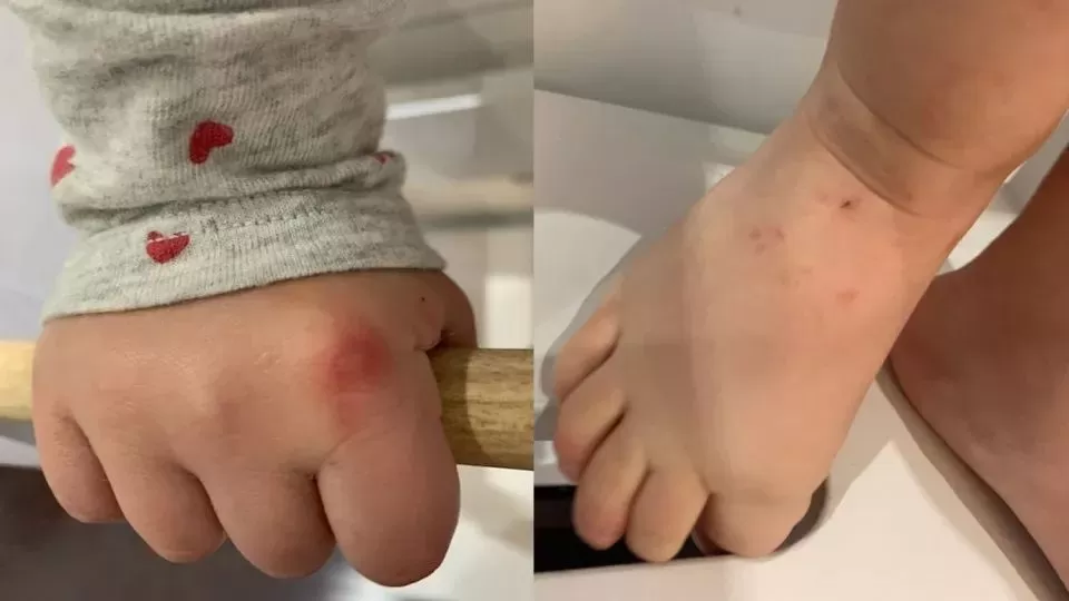 2周内至少9例! 华人喜爱的旅游胜地惊现致命病毒 多名加拿大儿童中枪