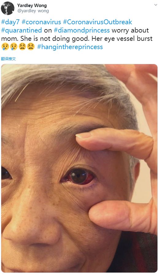 游轮确诊暴增至175人 检疫官惨感染! 加拿大夫妇哀嚎: 我们已成待宰羔羊!