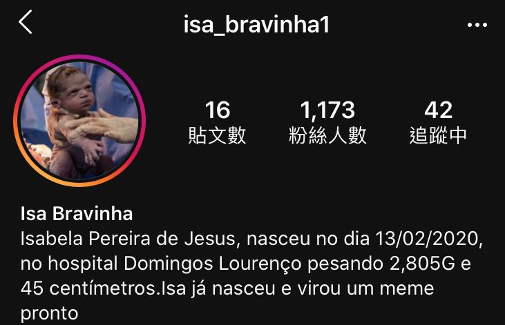笑喷! 宝宝一出生就暴怒 吓傻一屋子医生 接生照一夜之间火遍全球!