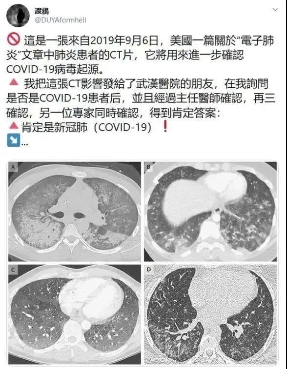 新冠肺炎0号病人，终于找到了：就是这名美国女军官