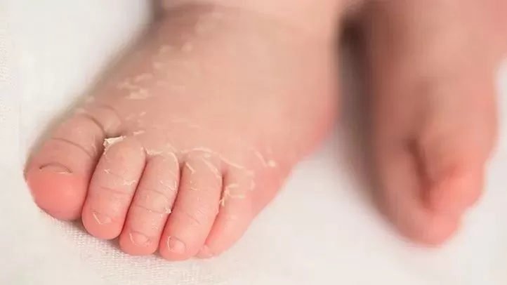 警惕! 大批儿童突染重疾 全身血管发炎 送进ICU后查出新冠阳性!