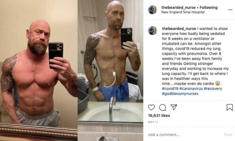 麦克感染新冠肺炎让他体重从86掉到63公斤，他在病房中花了好几分钟，用尽全力地从病床上站起来，拍摄了右边的照片。取材自BuzzFeedNews
