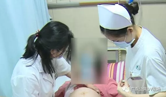 罕见!三胞胎分三次“出生”，第三胎迟了24天