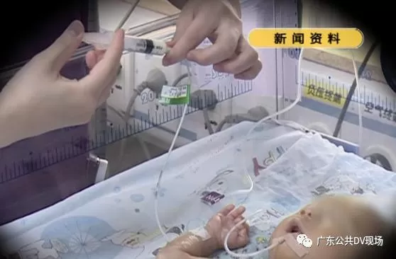 罕见!三胞胎分三次“出生”，第三胎迟了24天