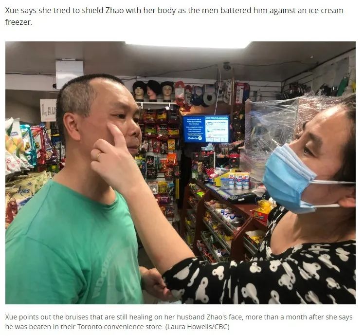 怒! 加拿大华人夫妇惨遭围殴暴打 鼻青脸肿浑身伤 只因提醒戴口罩!