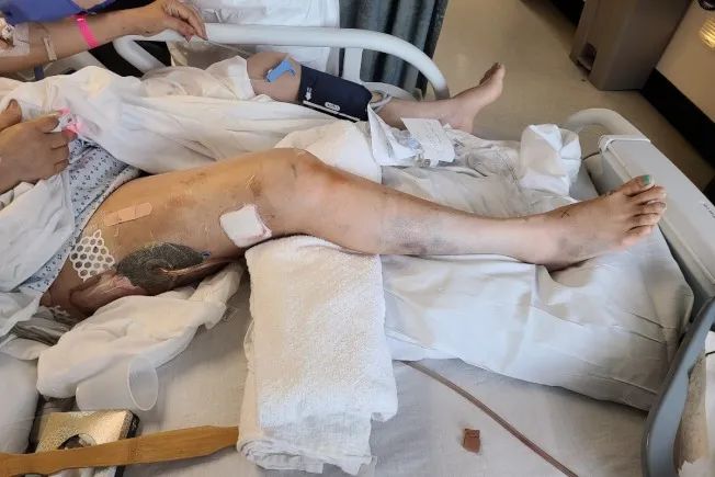 惨剧! 华人一家暴乱中遭洗劫 弃财逃命仍被打进ICU! 移民半生 一夜心冷!