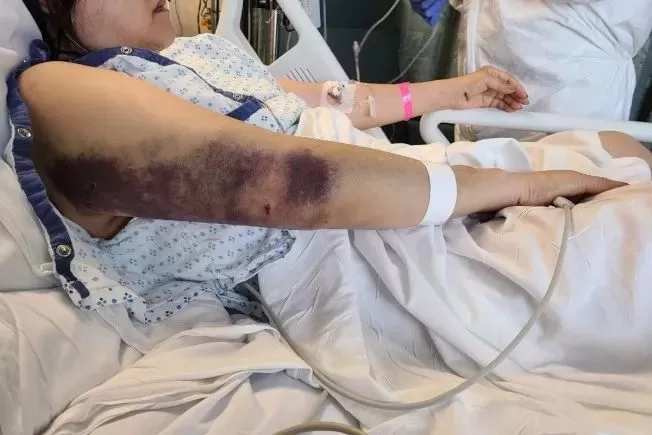 惨剧! 华人一家暴乱中遭洗劫 弃财逃命仍被打进ICU! 移民半生 一夜心冷!