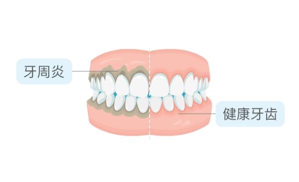 亲吻可能传播的4种疾病，很多人还不知道!