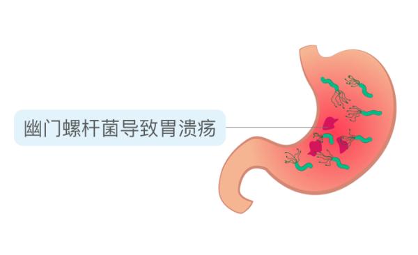 亲吻可能传播的4种疾病，很多人还不知道!