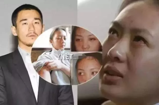 清纯女星曾被暴打雪藏 嫁大17岁富商熬出头 演人妻被出轨 火遍全网