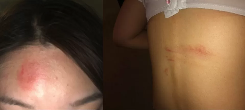 疯了! 温哥华亚裔女坐公交遭4白人围殴 暴打出血 大喊救命 竟无人帮忙!