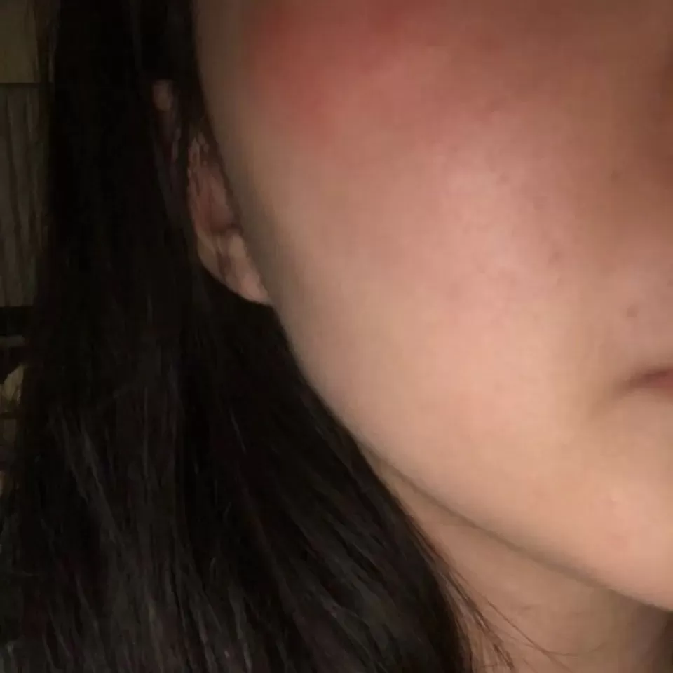 疯了! 温哥华亚裔女坐公交遭4白人围殴 暴打出血 大喊救命 竟无人帮忙!