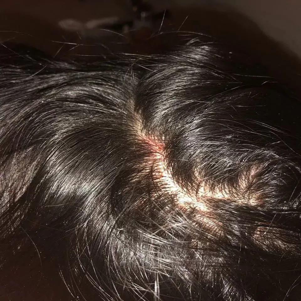 疯了! 温哥华亚裔女坐公交遭4白人围殴 暴打出血 大喊救命 竟无人帮忙!