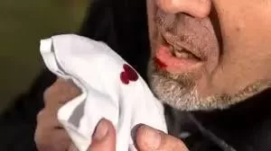 恐怖! 美国20岁小伙染疫身亡! 不是新冠 这病已夺去2亿人性命