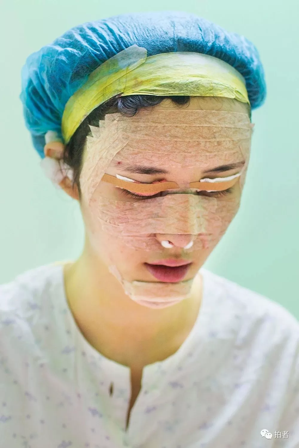 我用七年时间，记录上百个整容者的故事
