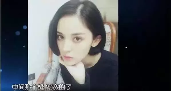 娜扎掉头发