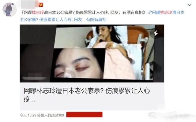 不能生育遭老公家暴离婚？林志玲七夕晒照否认