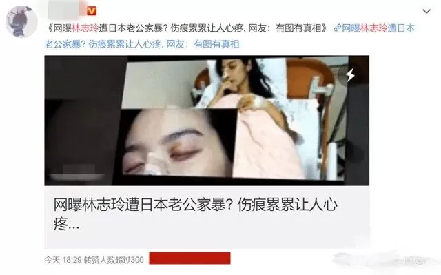 不能生育遭老公家暴离婚？林志玲七夕晒照否认