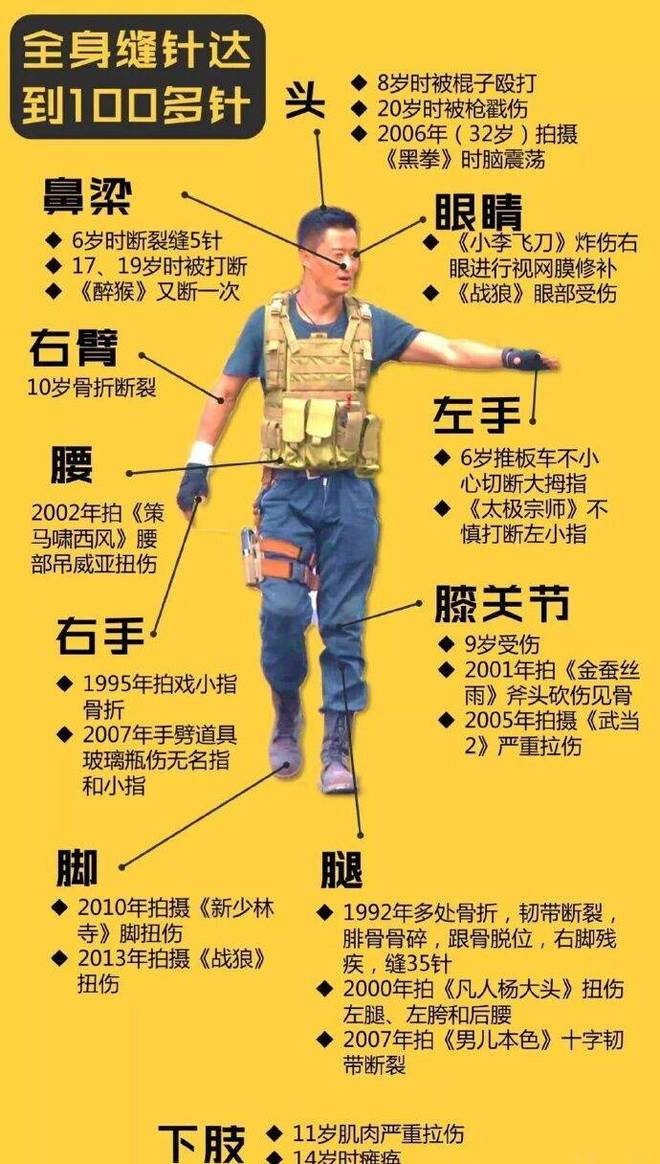 太拼！粉丝晒吴京全身受伤汇总图 全身缝100多针 