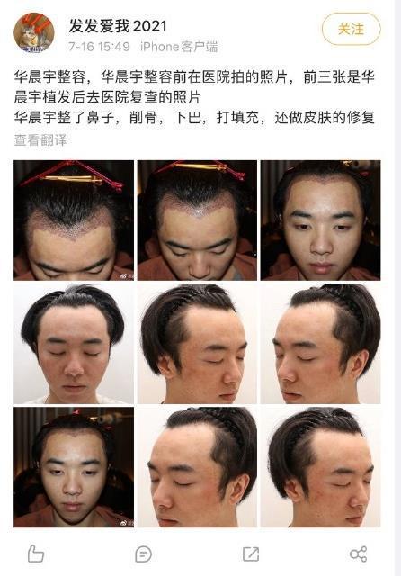 收钱了？女网友有华晨宇“床照”却秒认错 疑点太多
