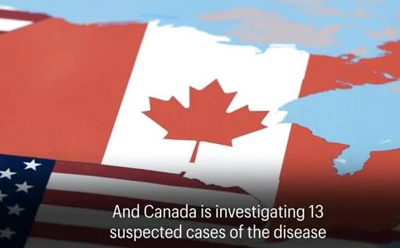 突发警报! 加拿大罕见猴痘感染扩大! 8天传12国 WHO紧急开会 恐已开始社区传播!?