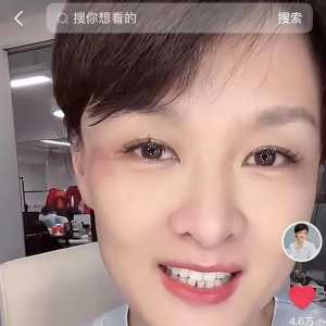 主持人李小萌被疑遭家暴 眼旁伤痕明显