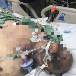 美华人社区爆发肢体冲突 一名华人死亡