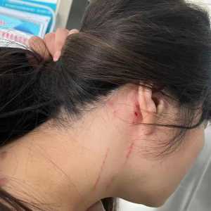只因回家过年拒绝相亲，河南母女竟被打伤入院