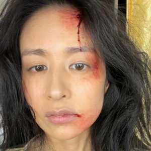 “甄嬛传”女星突曝家暴伤照 额头、嘴角流血画面惊人