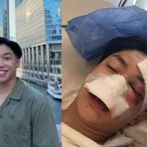 洛城亚裔男大生无端被群殴 满身是血重伤送医