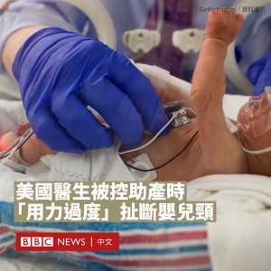 美佐治亚州母亲控诉：“噩梦般”的分娩 孩子身首异处