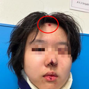 仇亚？华人留学生走洛杉矶街头 惨遭子弹“爆头”