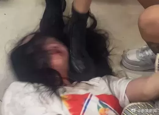 长沙女生不堪霸凌群殴 玻璃渣割颈求生 警方传唤嫌犯