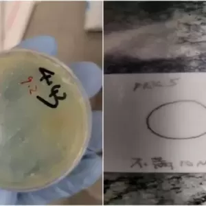 中国博士生在美被指走私生物材料 当局另加控3学者