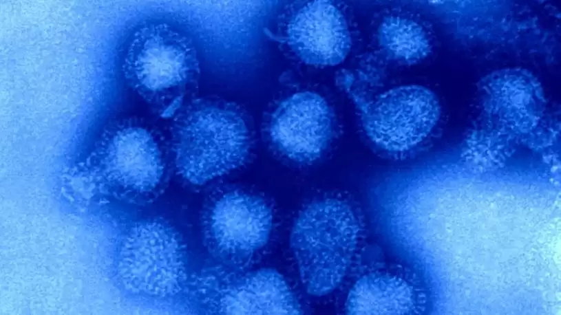 H3N2流感蔓延  今年疫苗不匹配  专家忧住院及死亡病例增