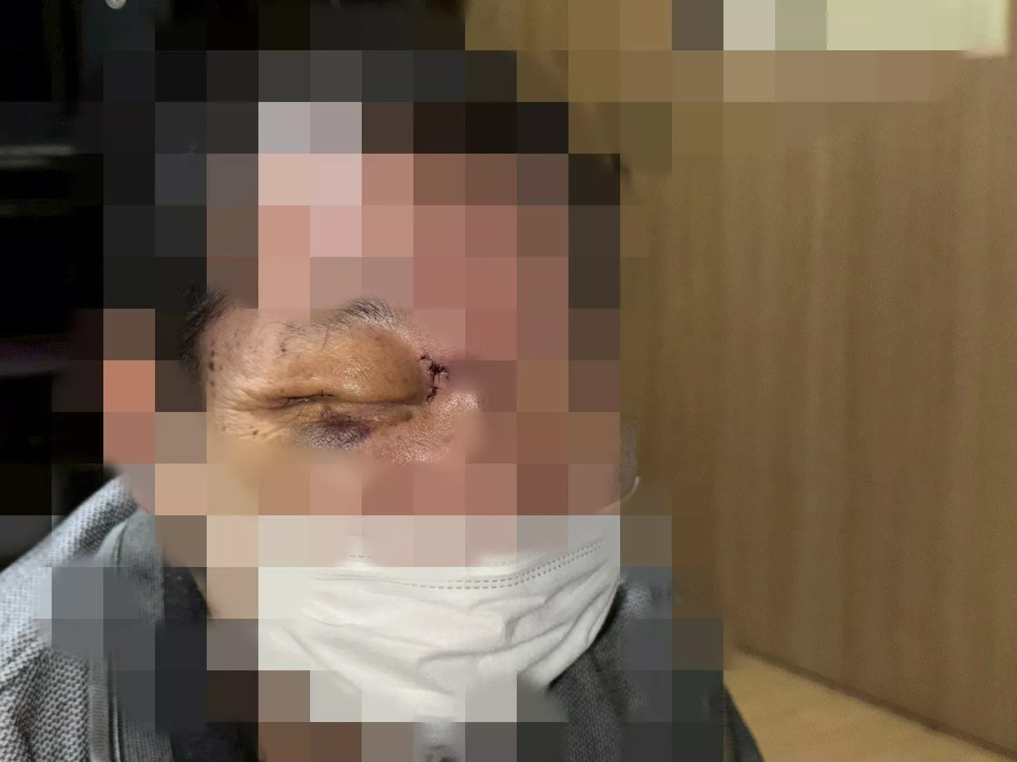 拉面店员击退熊：逃跑必死无疑 熊身硬如铁打到手痛