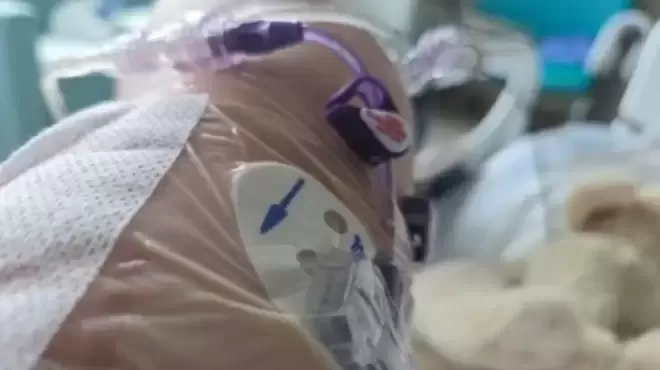手术后难以恢复：每六名老年患者中就有一人出现新残障或死亡