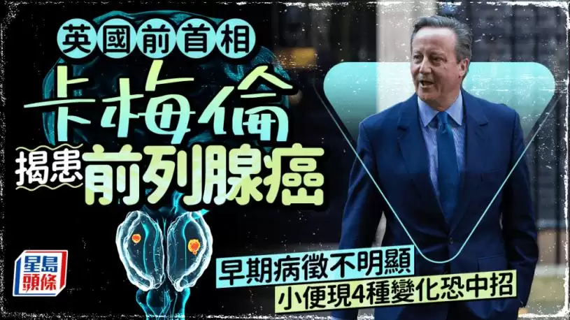 英国前首相卡梅伦揭患前列腺癌  早期病征不明显 小便现4种变化恐中招