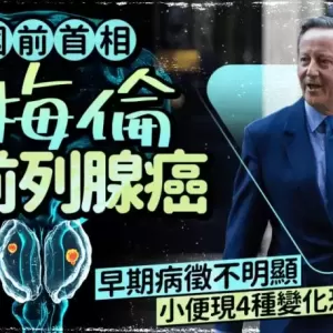 英国前首相卡梅伦揭患前列腺癌  早期病征不明显 小便现4种变化恐中招