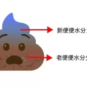 上厕所时 大便“前硬后软”？当心是身体在报警